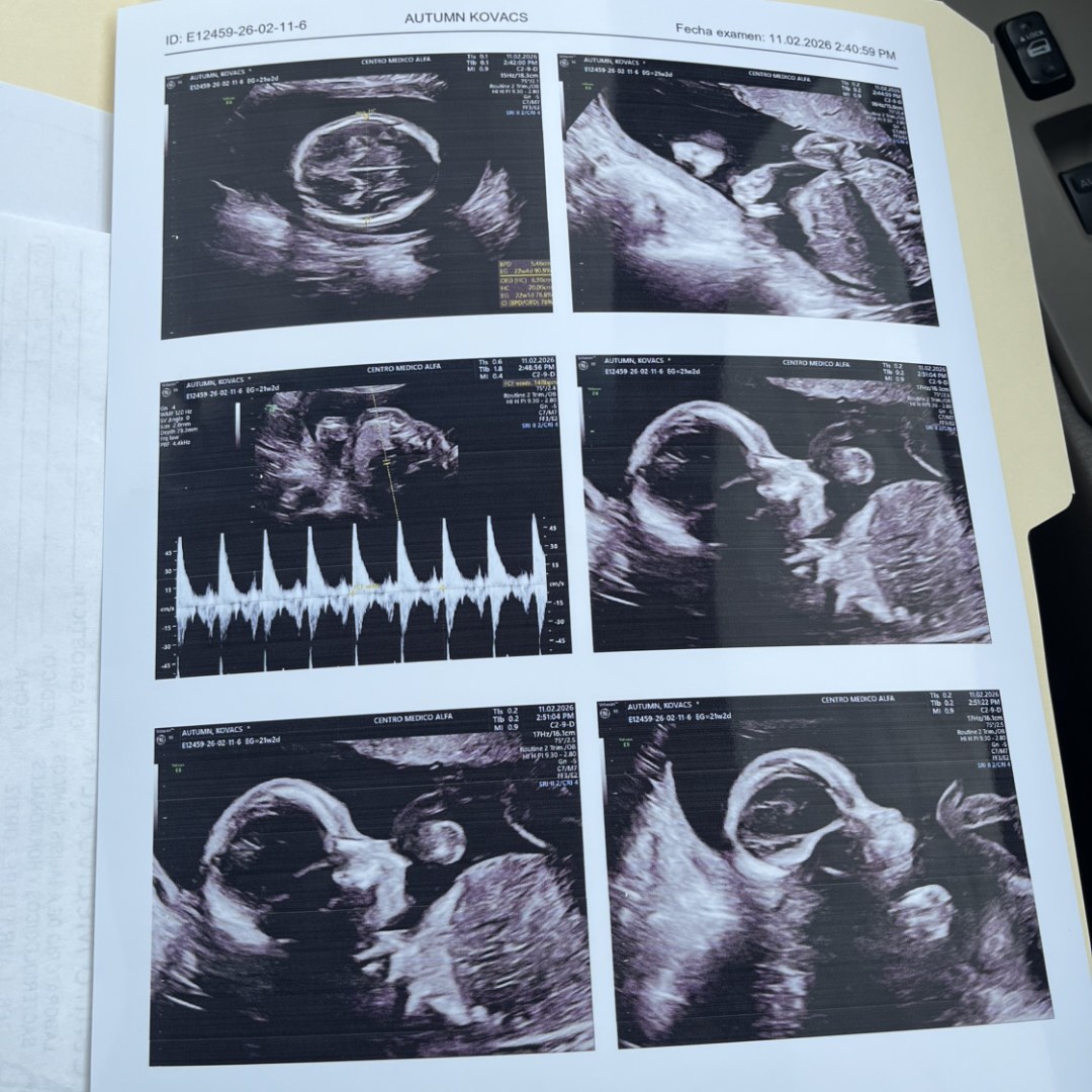 Photo shared by Autumn for their Babylist baby registry.