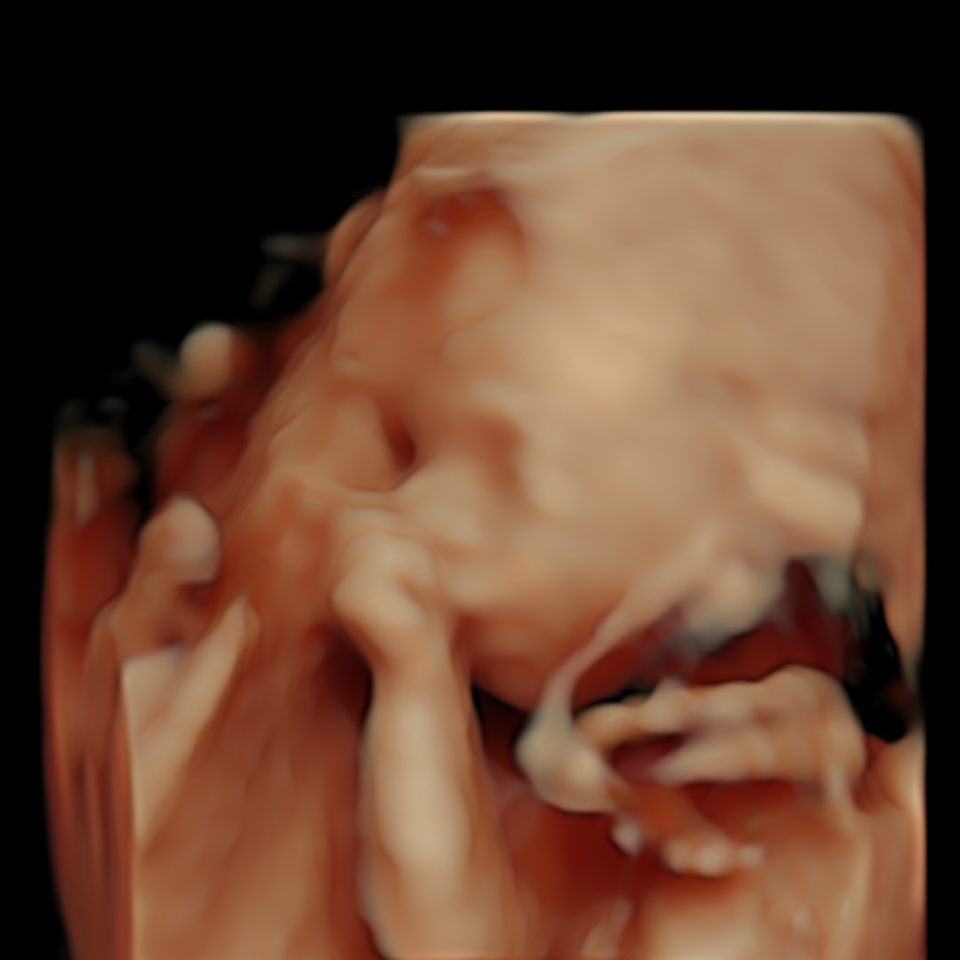 Photo shared by Jacobi for their Babylist baby registry.
