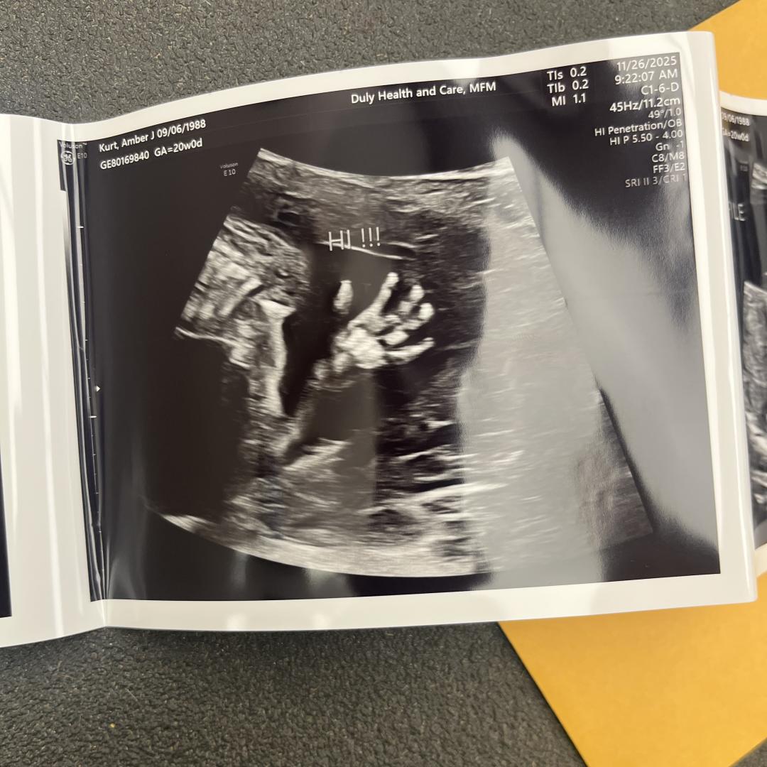 Photo shared by Amber for their Babylist baby registry.