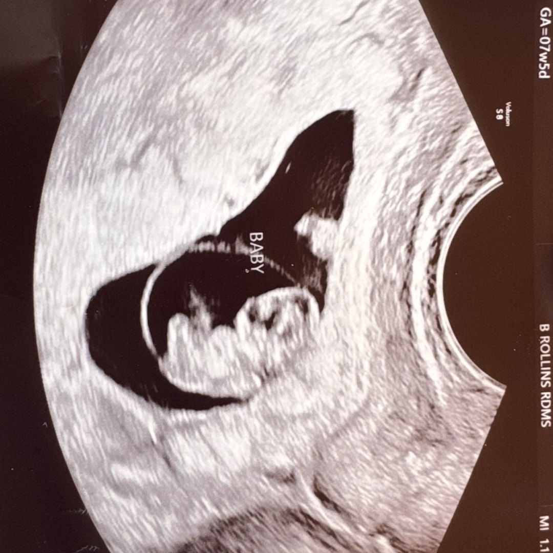 Photo shared by Jessa for their Babylist baby registry.