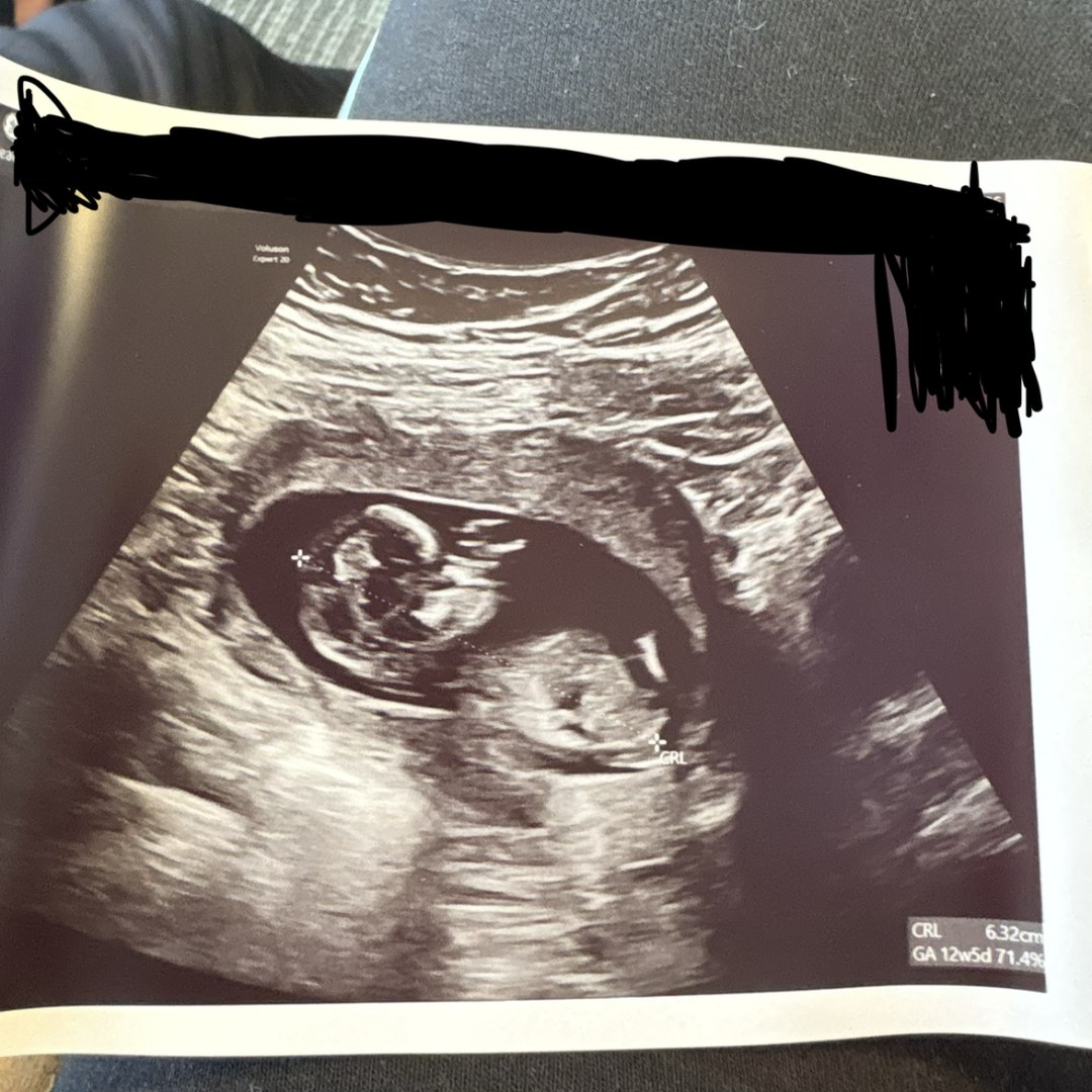 Photo shared by Annalisa for their Babylist baby registry.