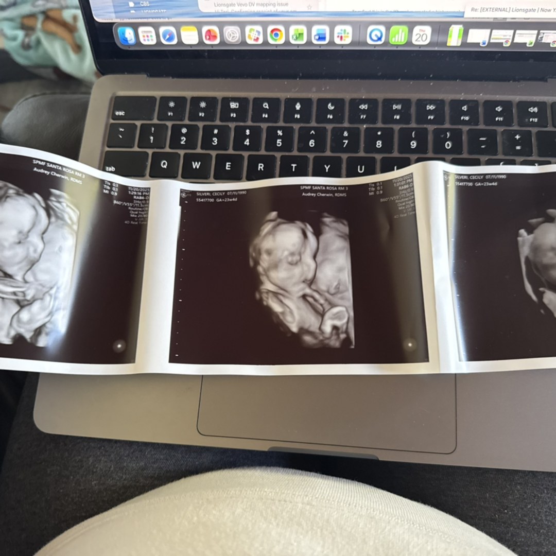 Photo shared by Cecily for their Babylist baby registry.