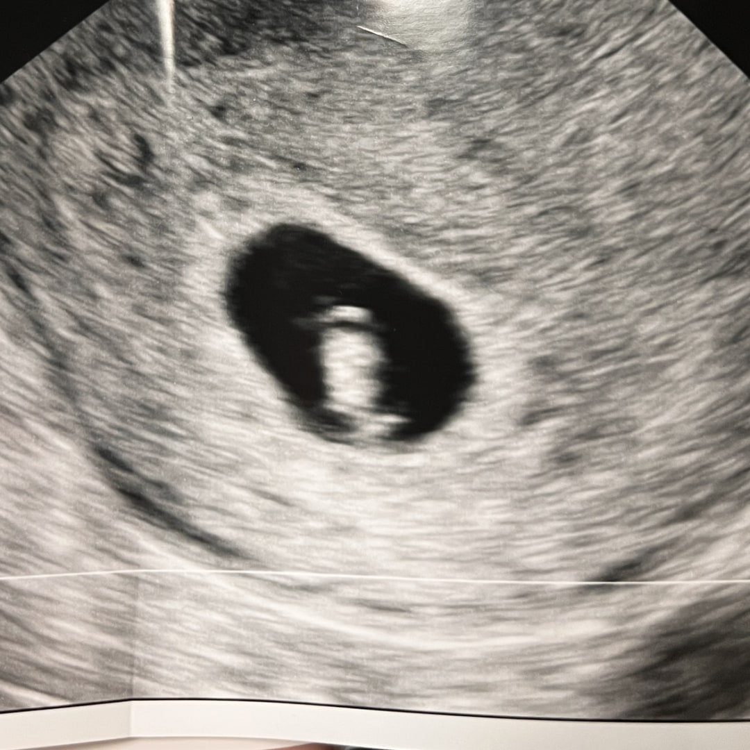 Photo shared by Elaina for their Babylist baby registry.