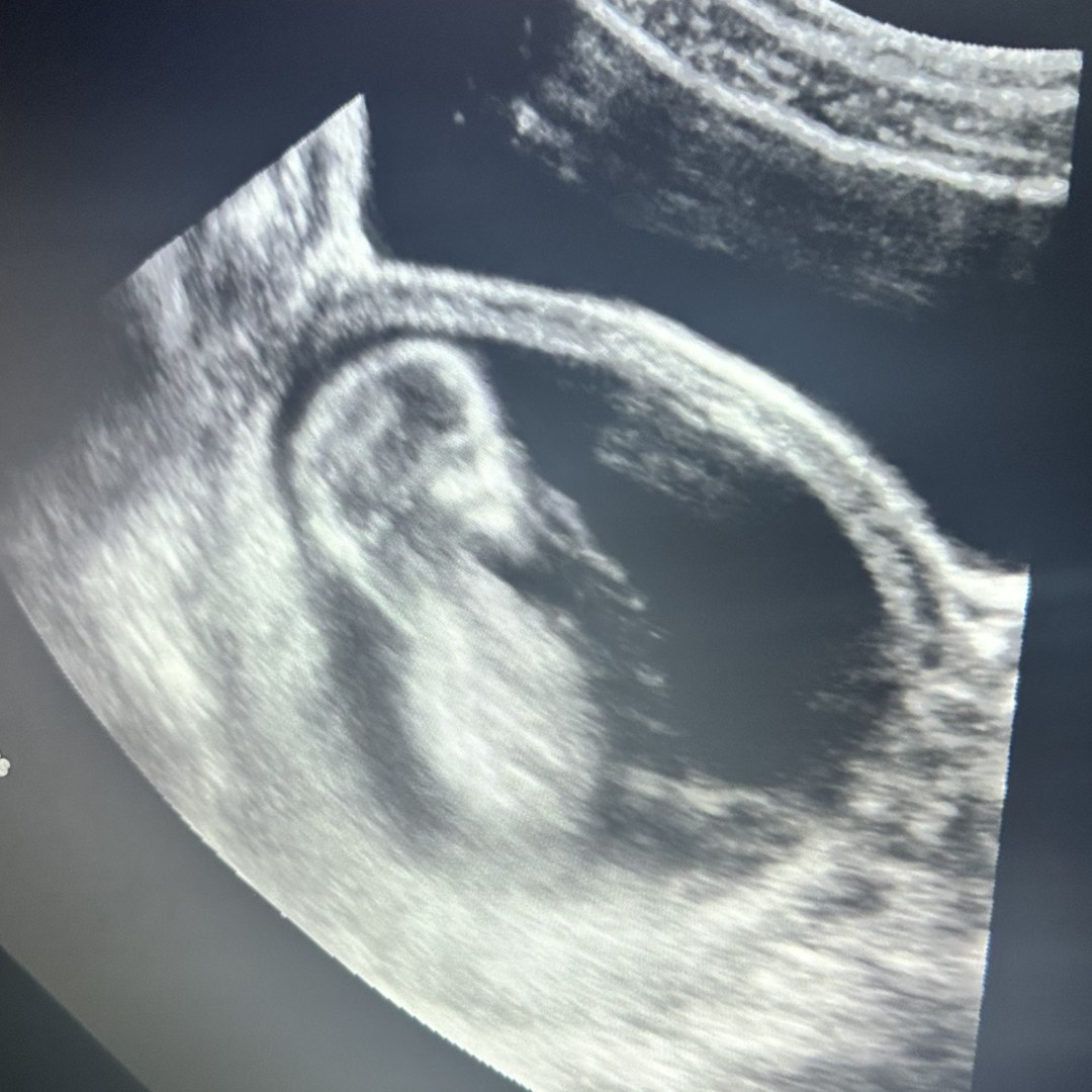 Photo shared by Meghan for their Babylist baby registry.