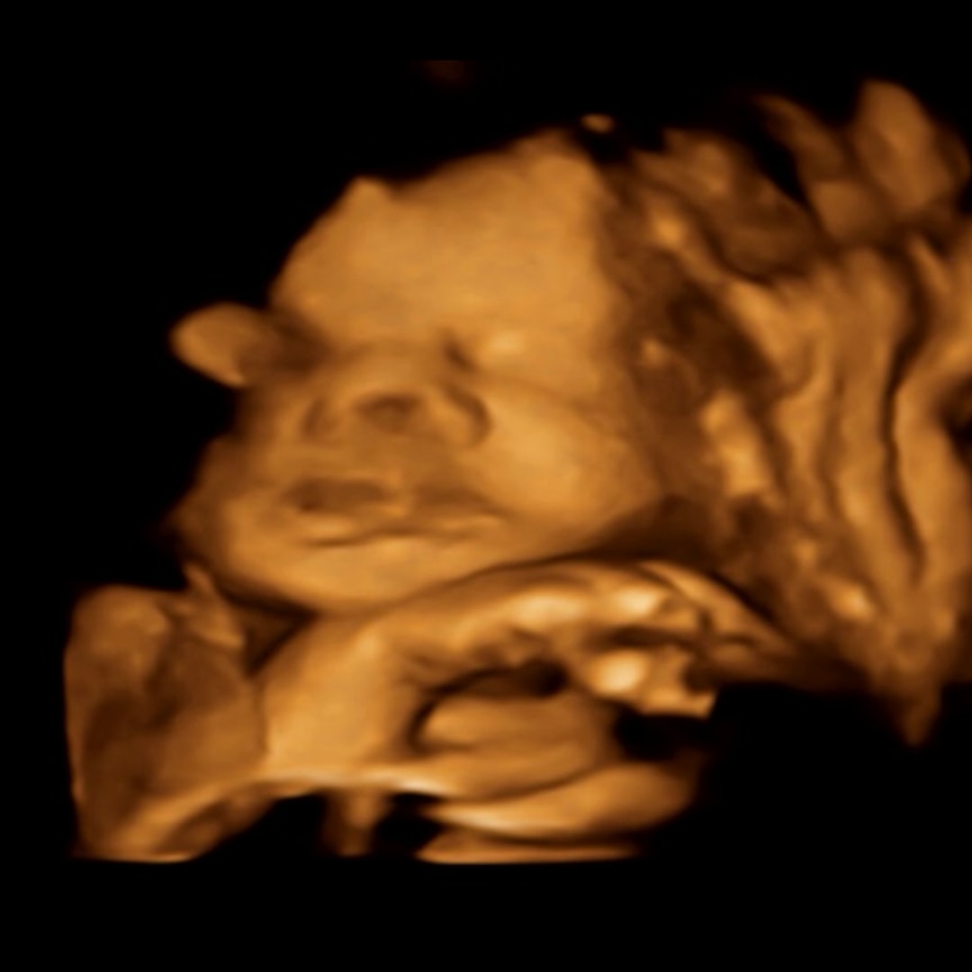 Photo shared by Kitt for their Babylist baby registry.