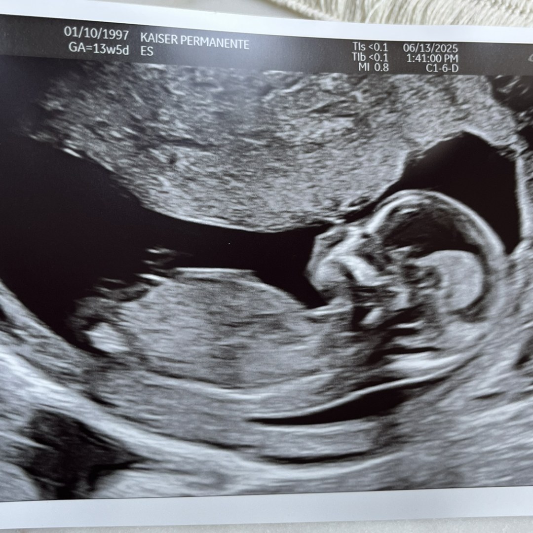Photo shared by Courtney for their Babylist baby registry.