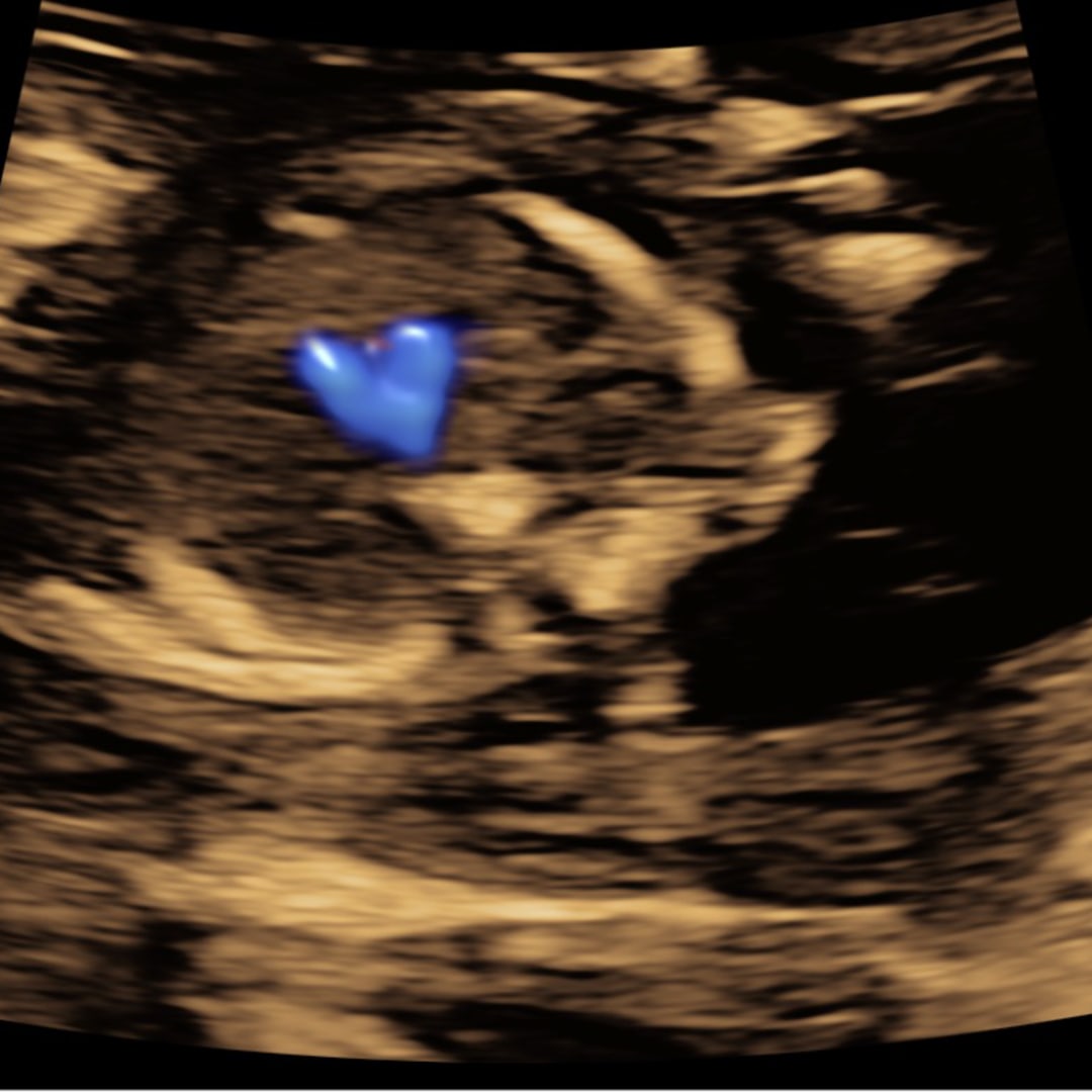 Photo shared by Ashley for their Babylist baby registry.