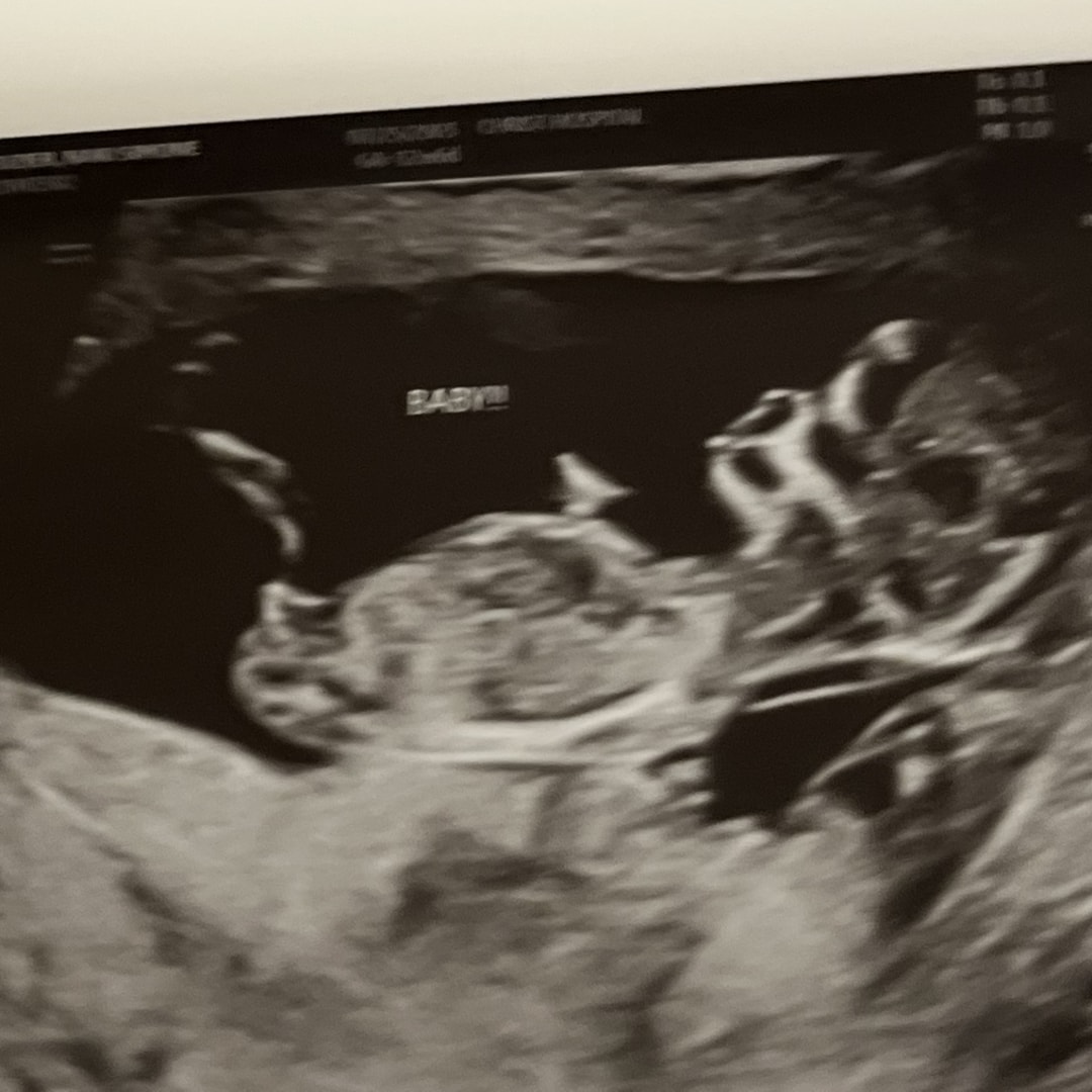 Photo shared by Naki for their Babylist baby registry.