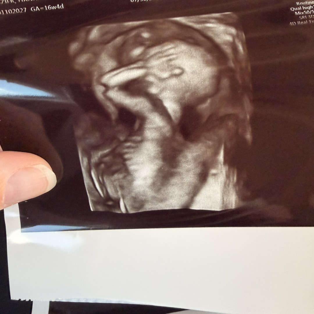 Photo shared by Hannah for their Babylist baby registry.