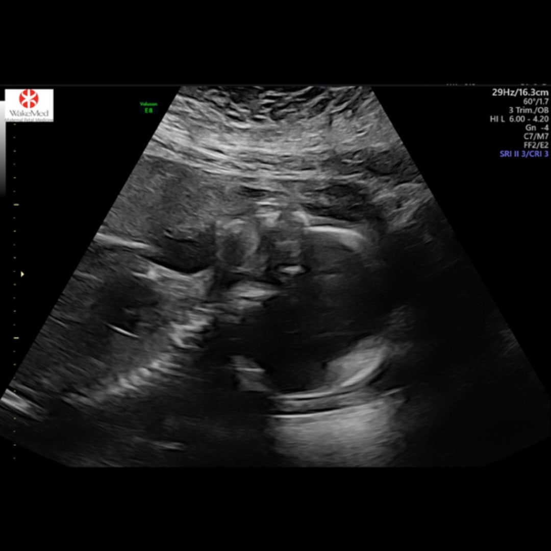 Photo shared by Makenzie for their Babylist baby registry.