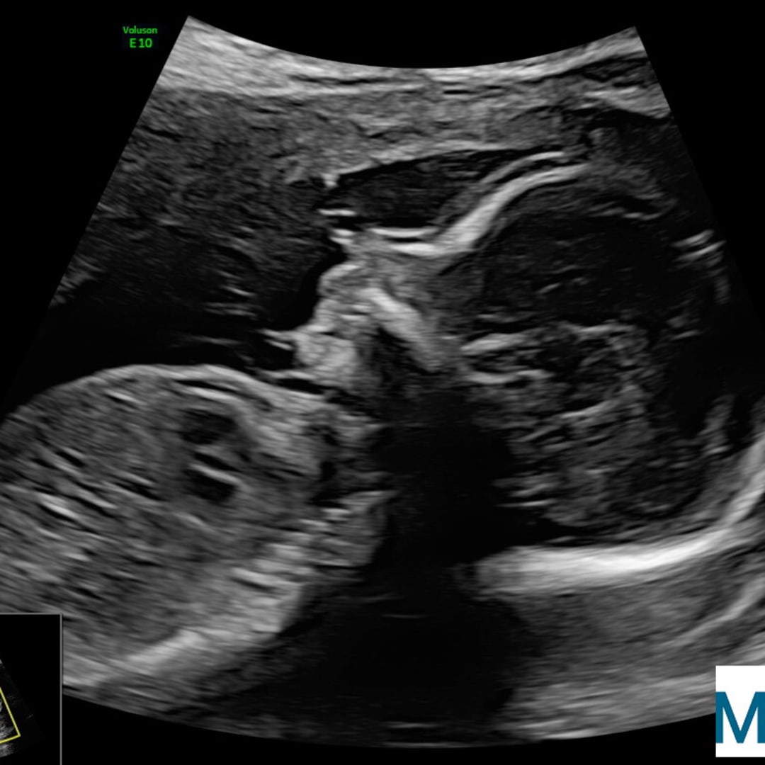 Photo shared by Gabriella for their Babylist baby registry.