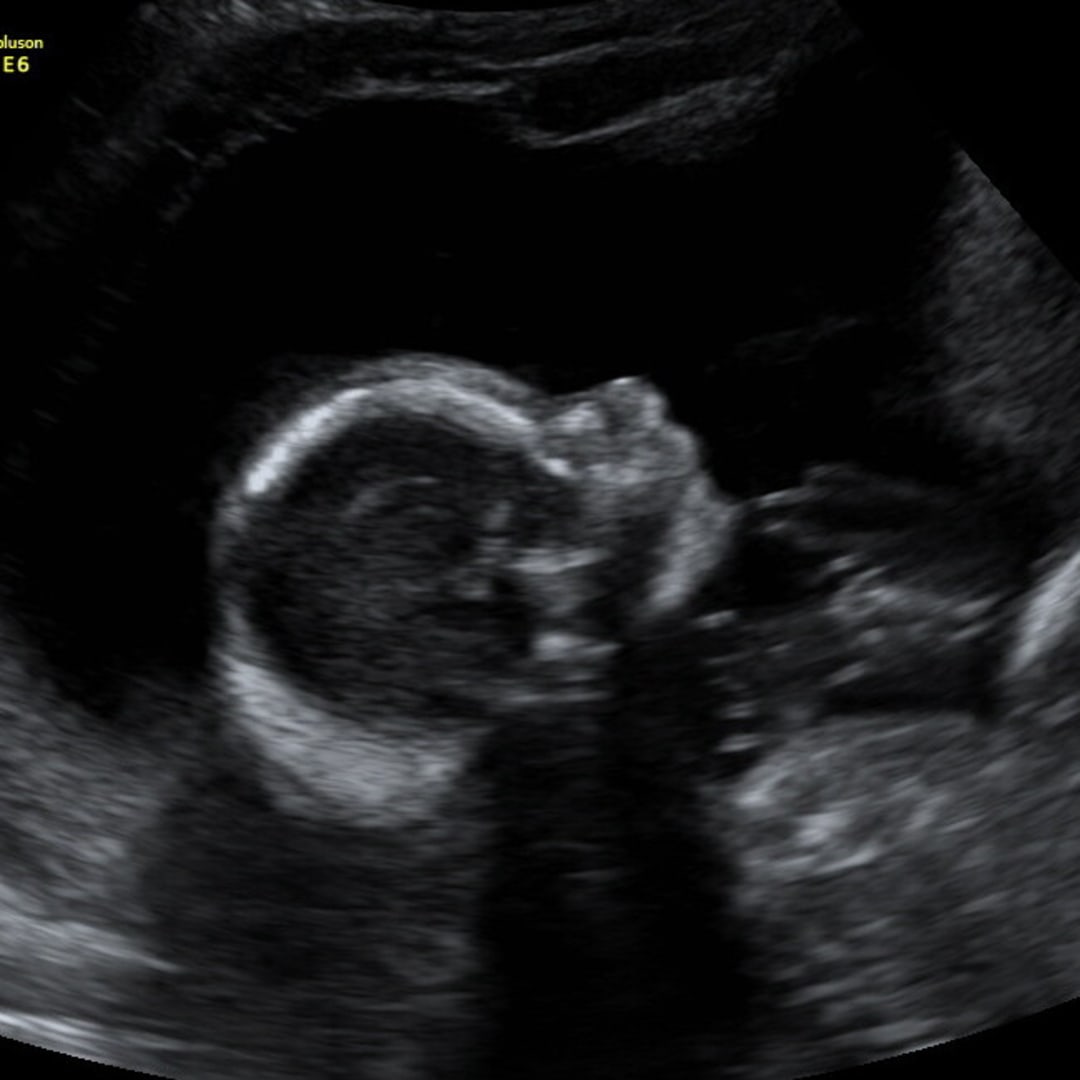 Photo shared by Brooke for their Babylist baby registry.