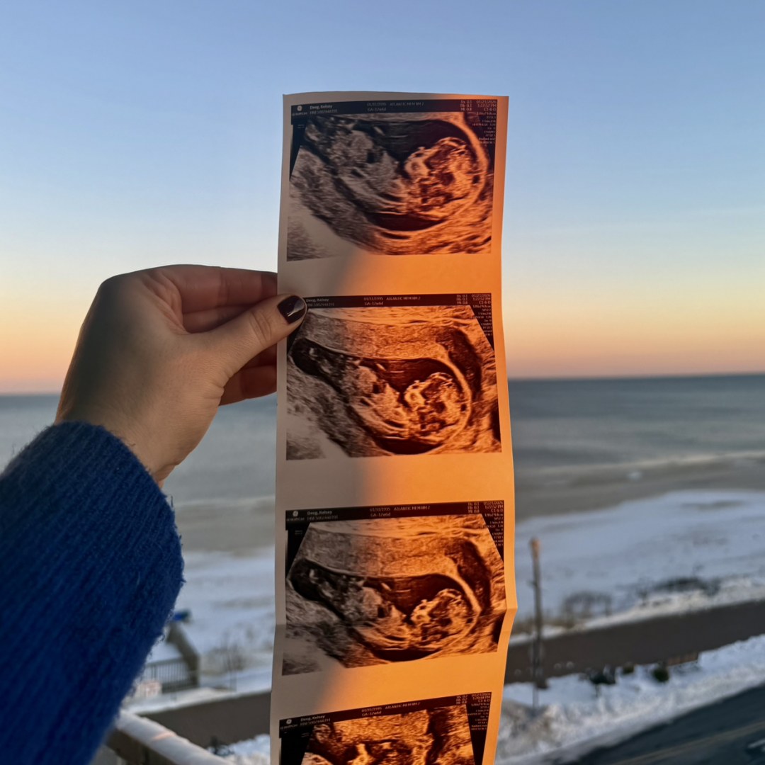 Photo shared by Kelsey for their Babylist baby registry.