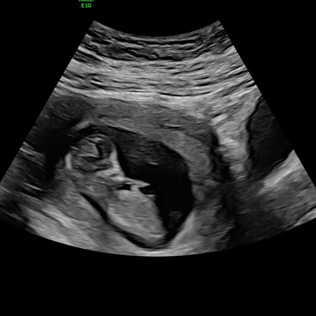 Photo shared by Gabriela for their Babylist baby registry.