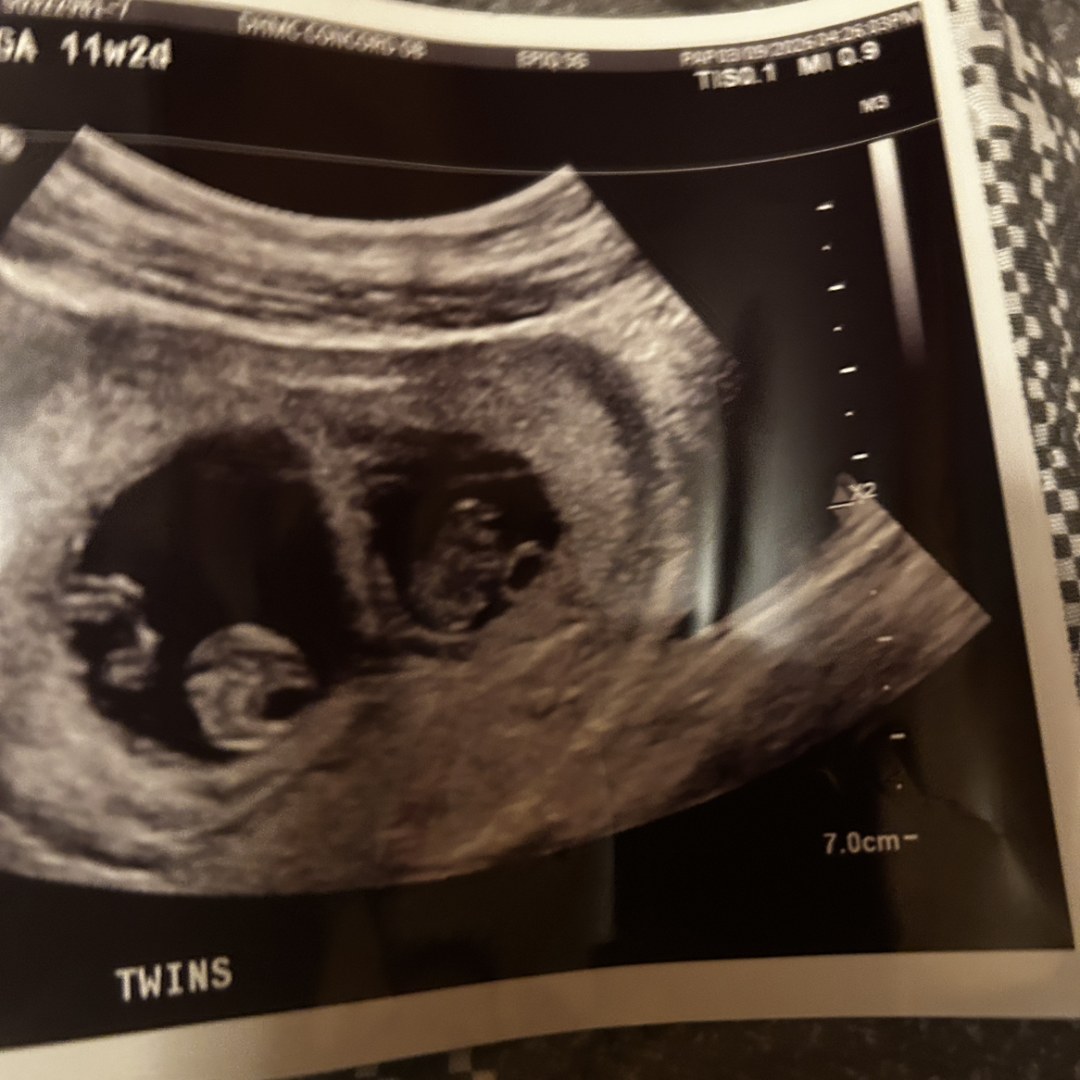 Photo shared by Jasmine for their Babylist baby registry.