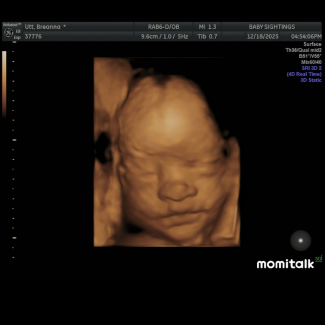 Photo shared by Breanna for their Babylist baby registry.