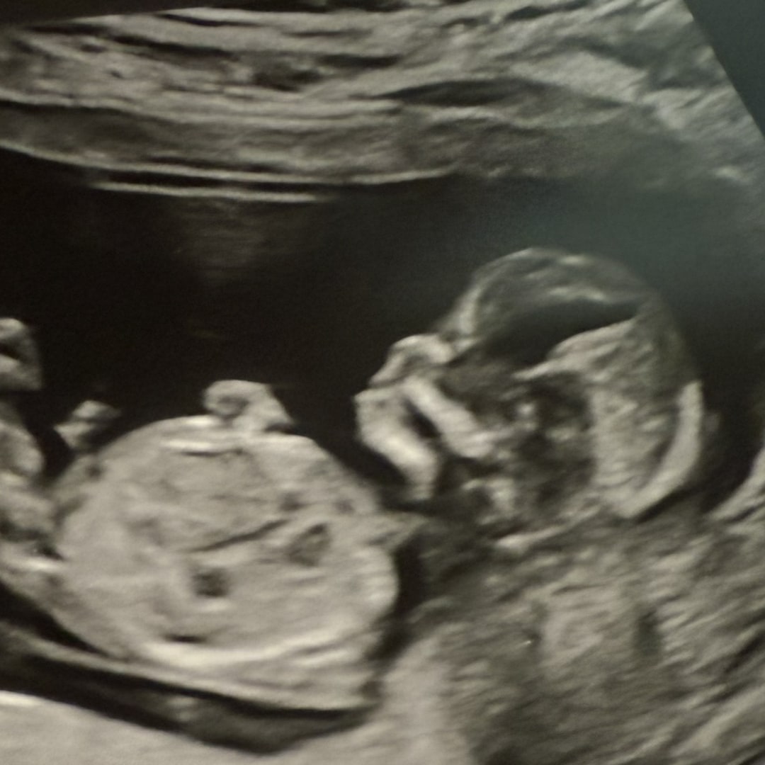 Photo shared by Shauna for their Babylist baby registry.