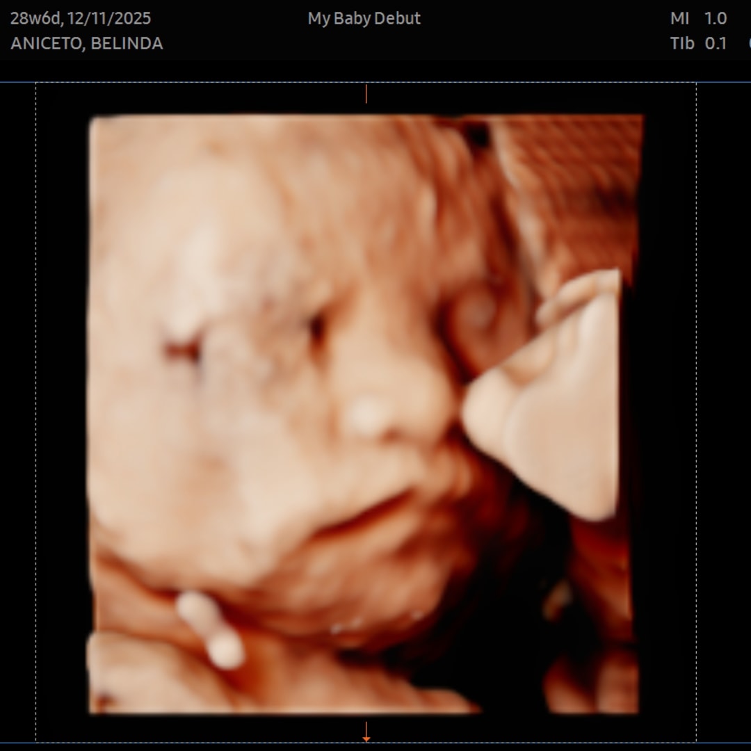 Photo shared by Belinda for their Babylist baby registry.