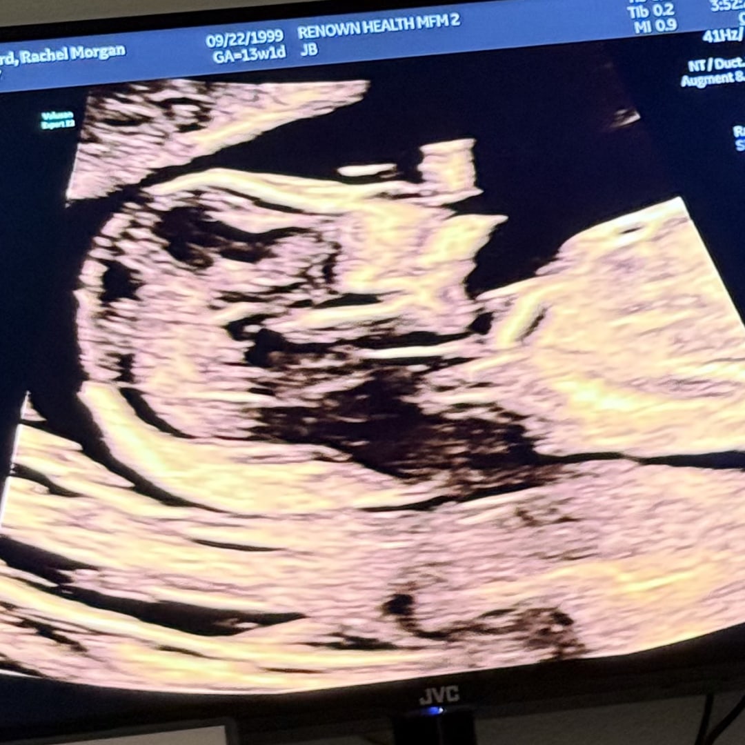Photo shared by Rachel for their Babylist baby registry.