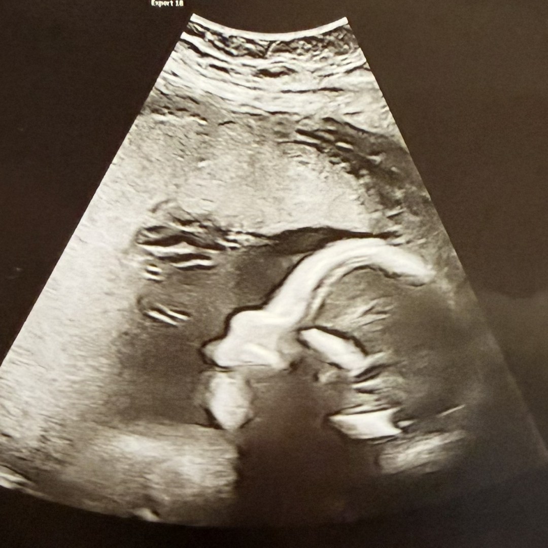 Photo shared by Terrah for their Babylist baby registry.