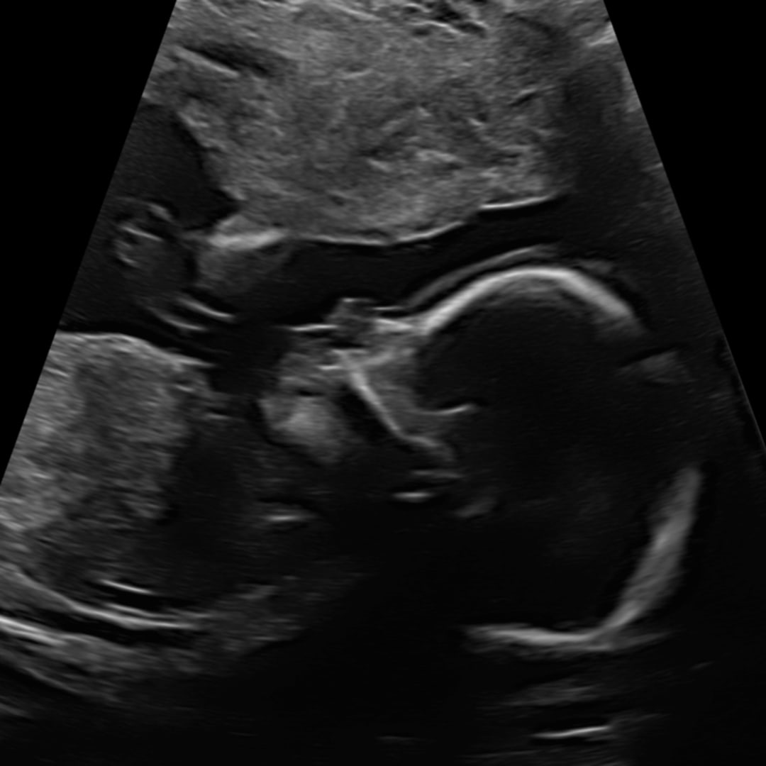 Photo shared by Jessie for their Babylist baby registry.