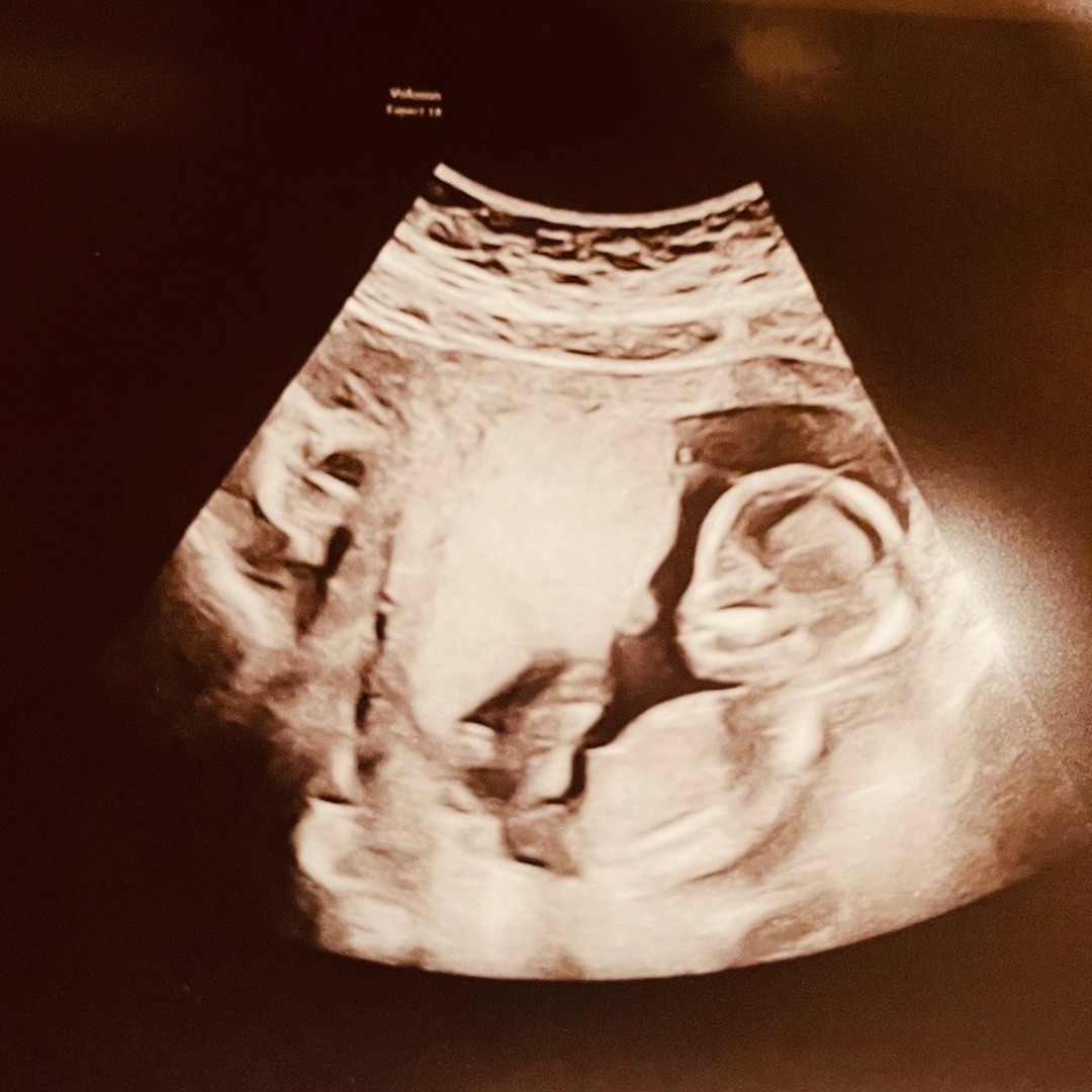 Photo shared by Cheron for their Babylist baby registry.