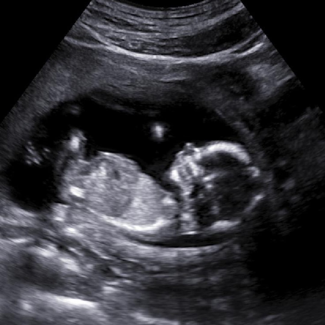 Photo shared by Ana Sofia for their Babylist baby registry.