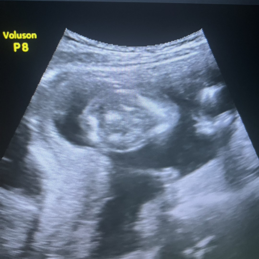 Photo shared by Tink for their Babylist baby registry.