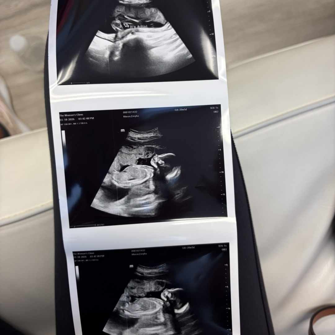 Photo shared by Emylia for their Babylist baby registry.