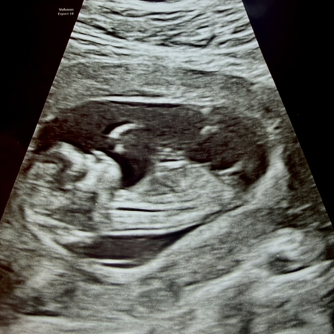 Photo shared by Lindsey for their Babylist baby registry.