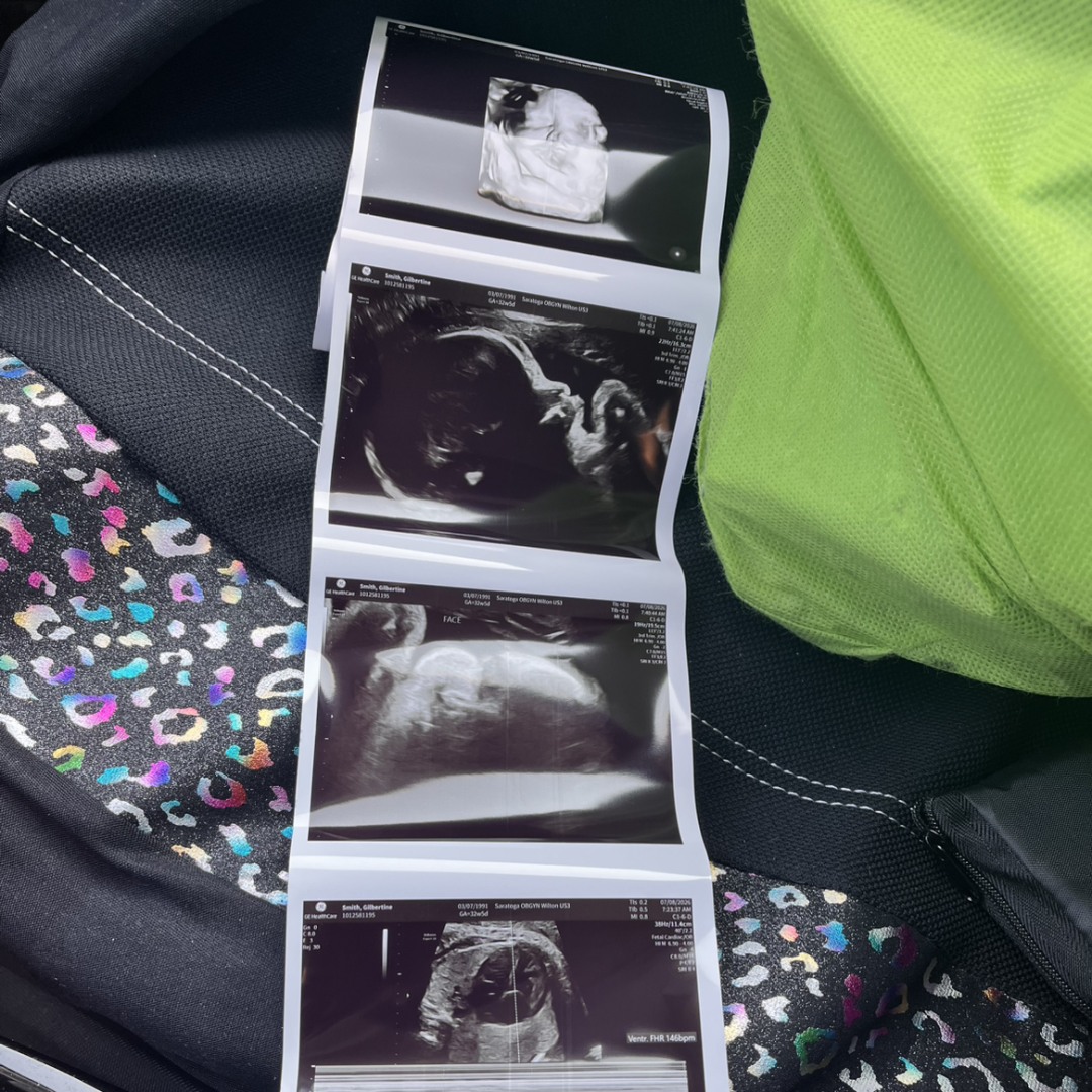 Photo shared by Gilly for their Babylist baby registry.