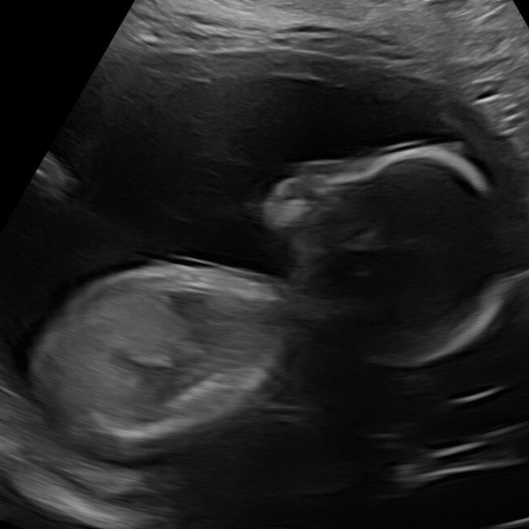 Photo shared by Sharon for their Babylist baby registry.