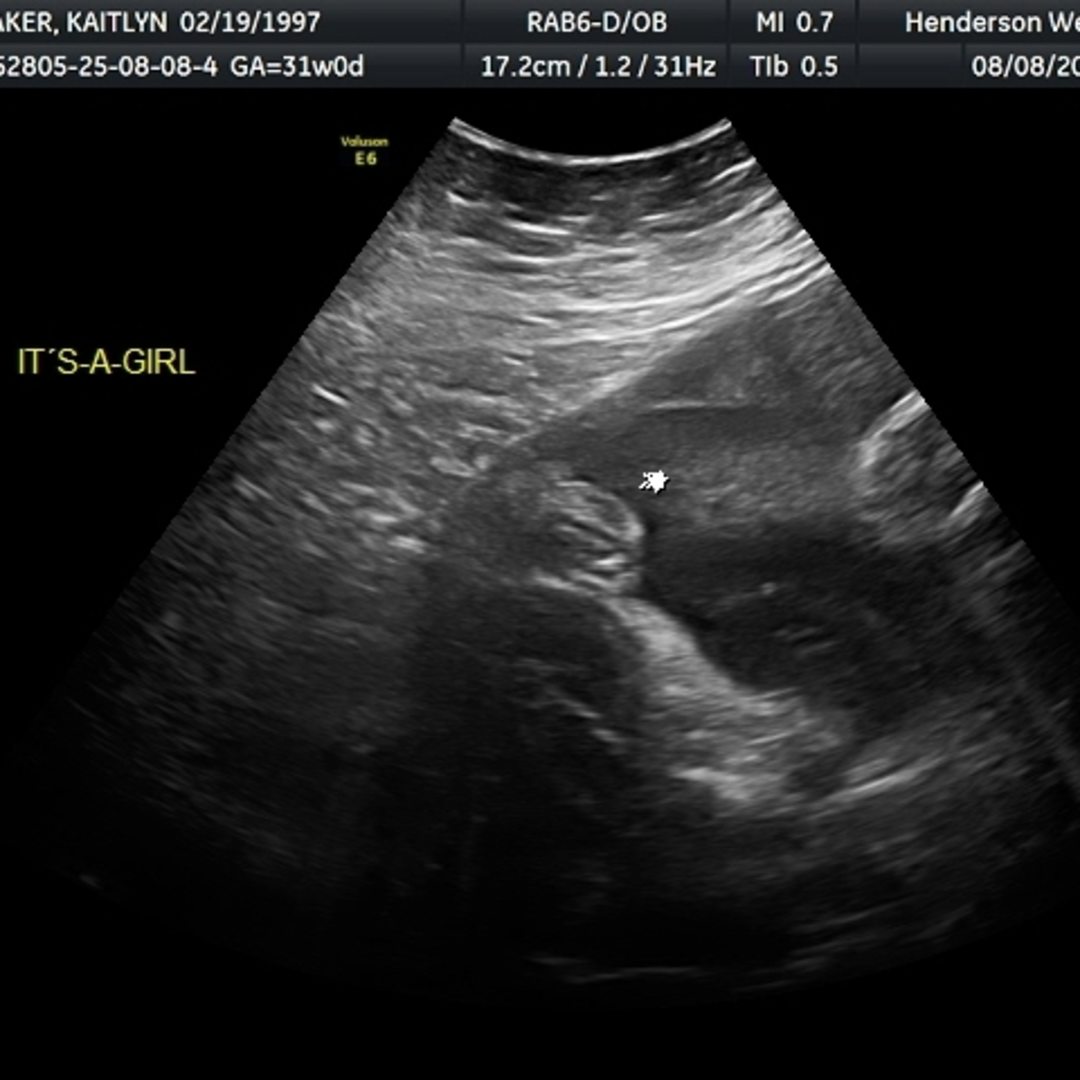 Photo shared by Kaitlyn for their Babylist baby registry.