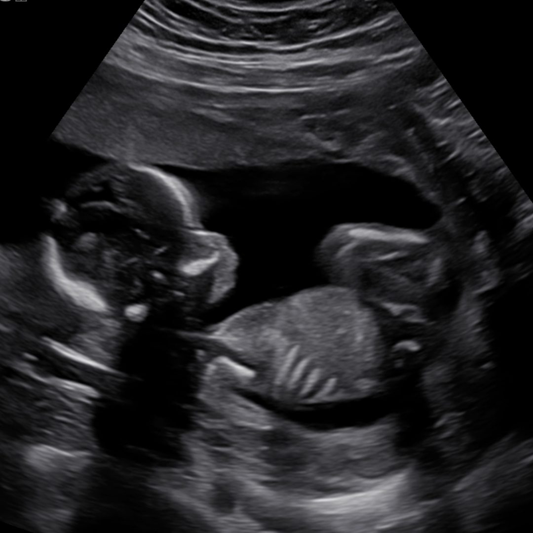 Photo shared by Shante for their Babylist baby registry.