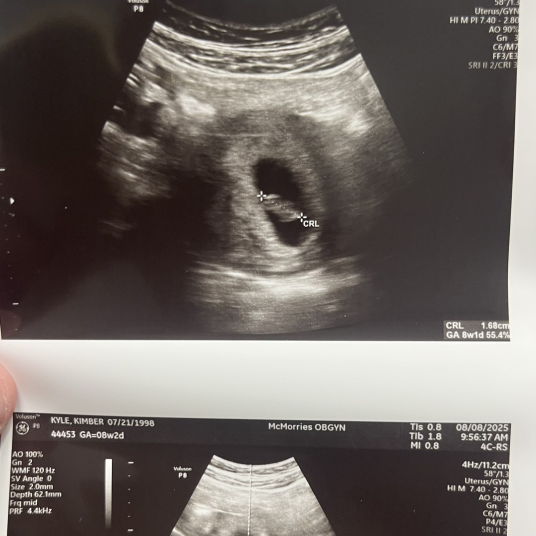 Photo shared by Kimber for their Babylist baby registry.