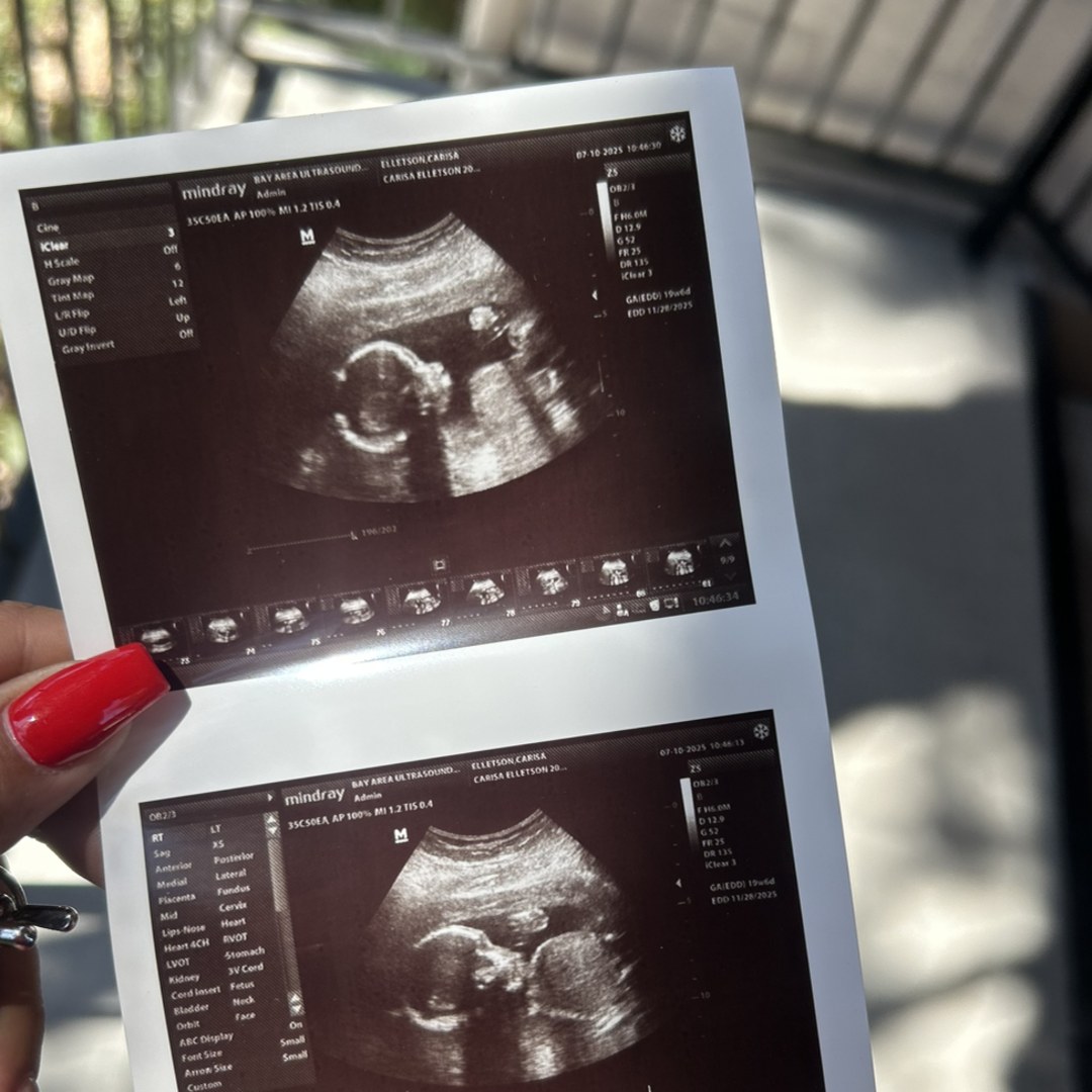 Photo shared by Carisa for their Babylist baby registry.
