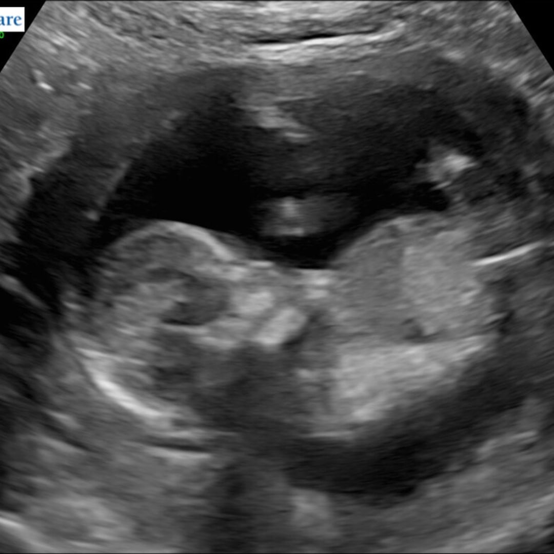 Photo shared by Joy for their Babylist baby registry.