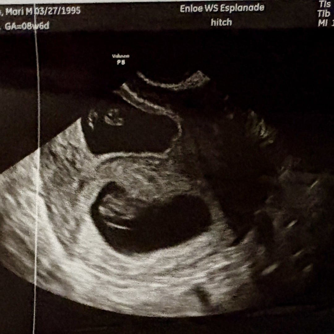 Photo shared by Mari for their Babylist baby registry.