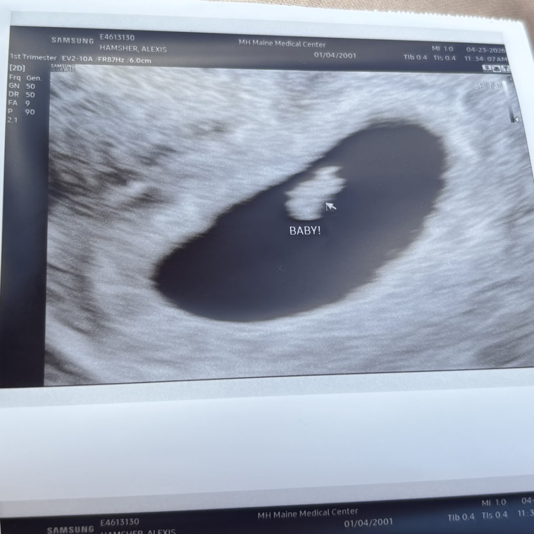 Photo shared by Alexis for their Babylist baby registry.