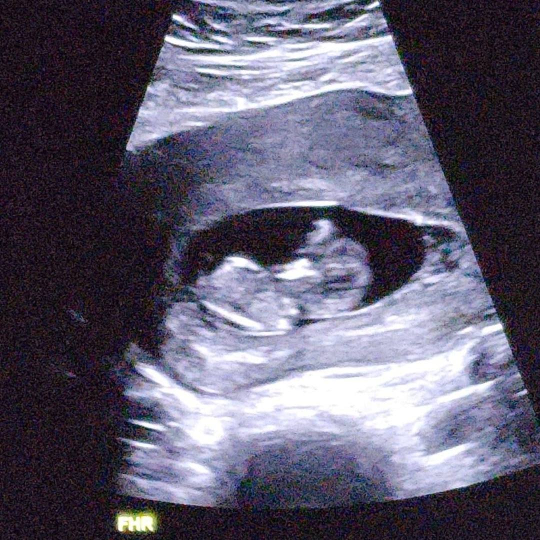 Photo shared by Alberto for their Babylist baby registry.