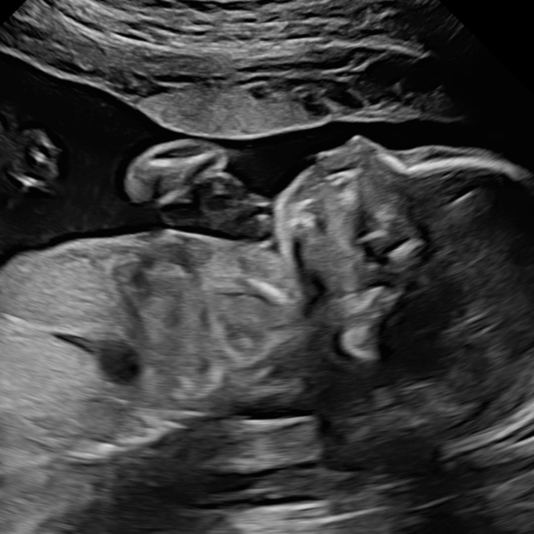 Photo shared by Claudia for their Babylist baby registry.