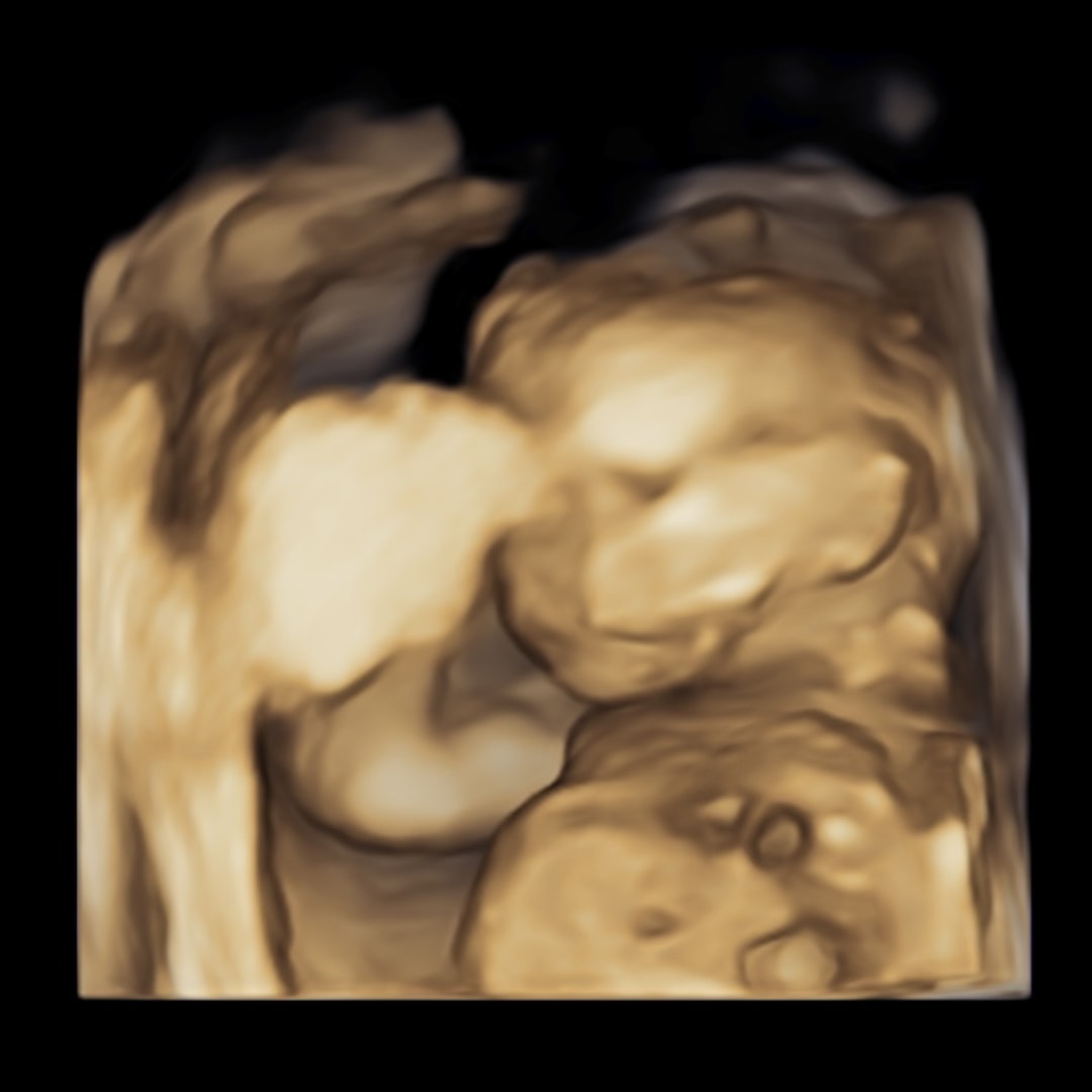Photo shared by Victoria for their Babylist baby registry.