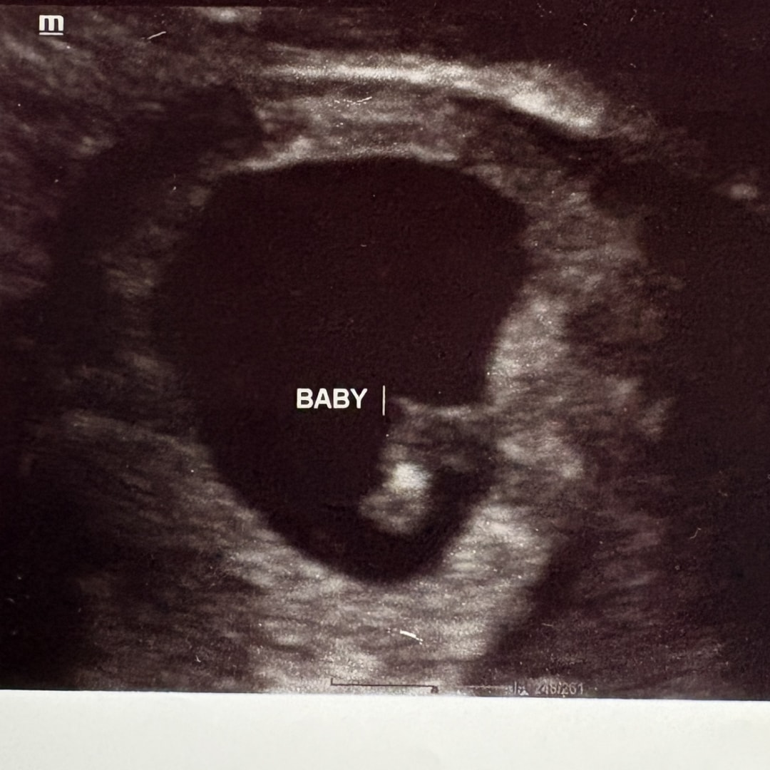 Photo shared by Abbi for their Babylist baby registry.