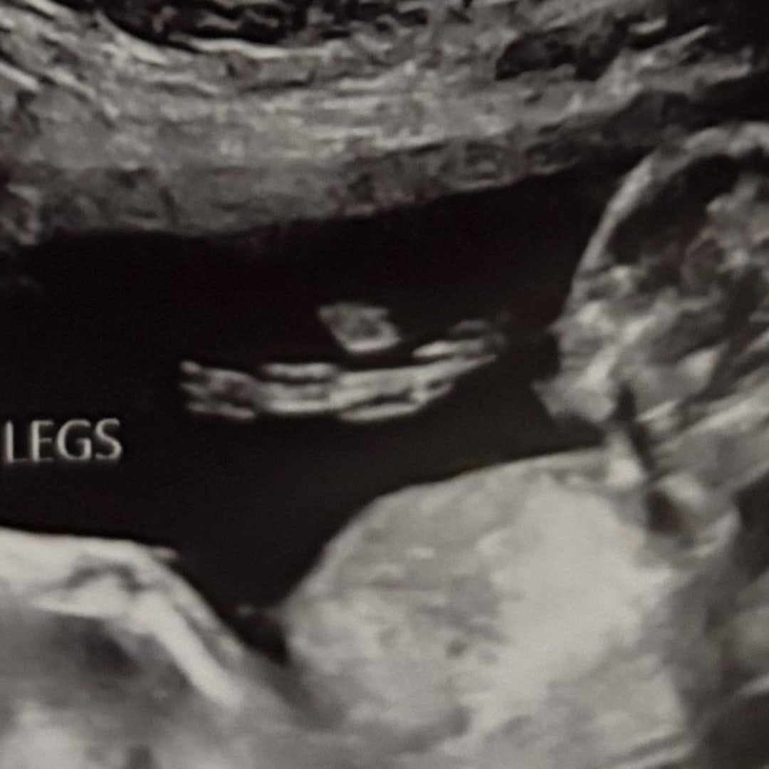 Photo shared by Emilie for their Babylist baby registry.
