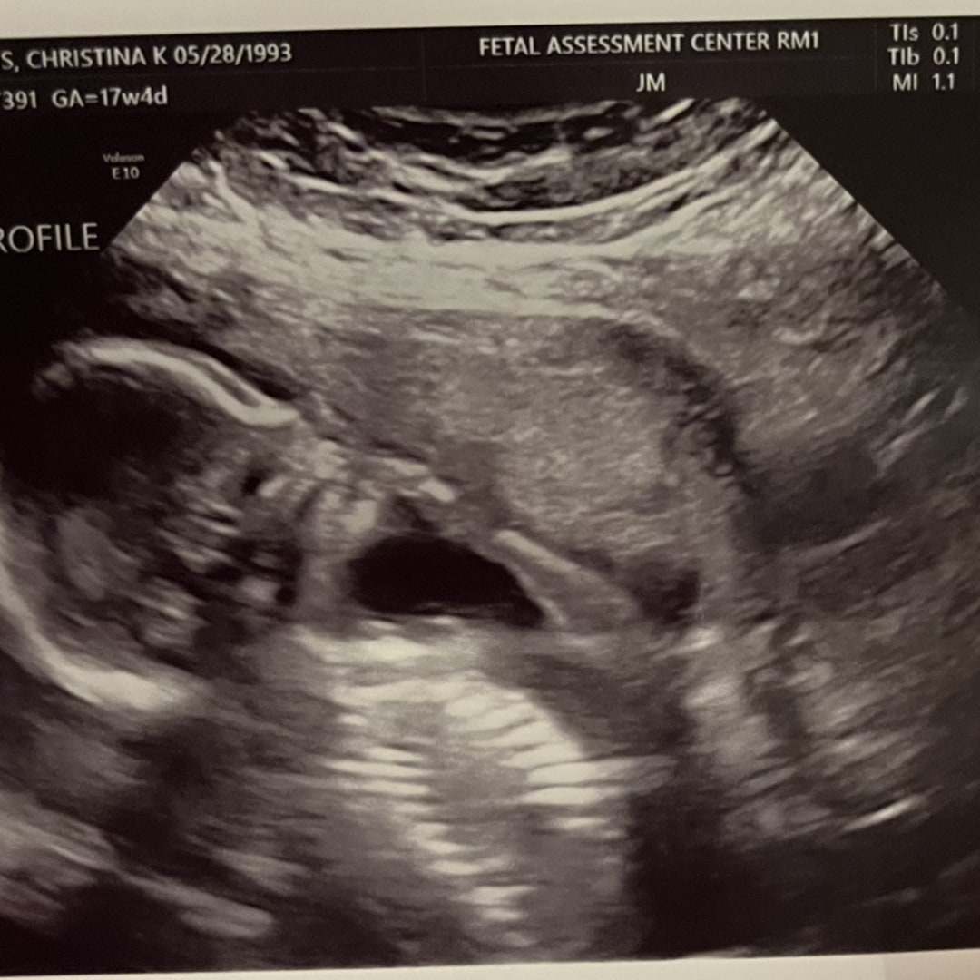 Photo shared by Christina for their Babylist baby registry.