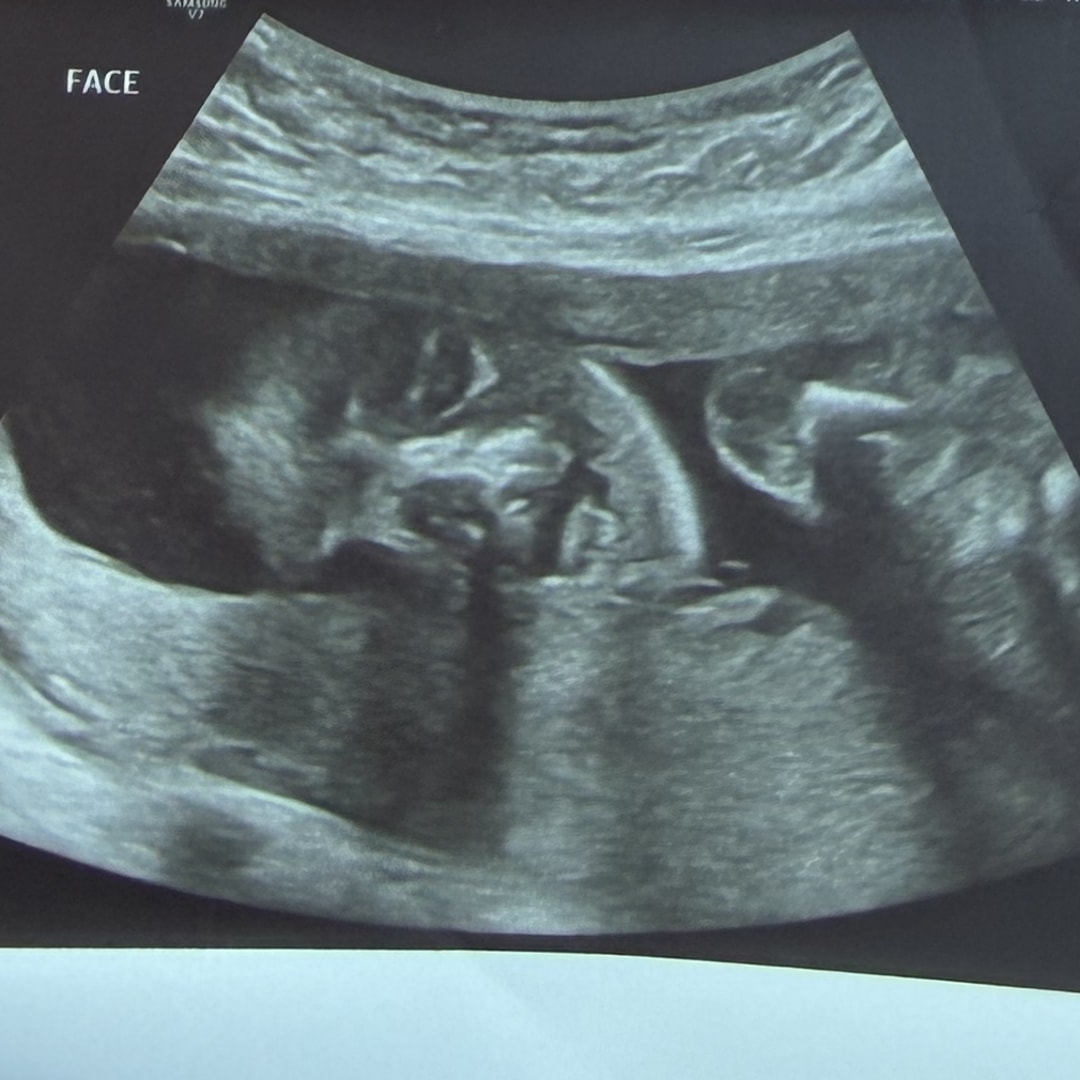 Photo shared by Brittany for their Babylist baby registry.