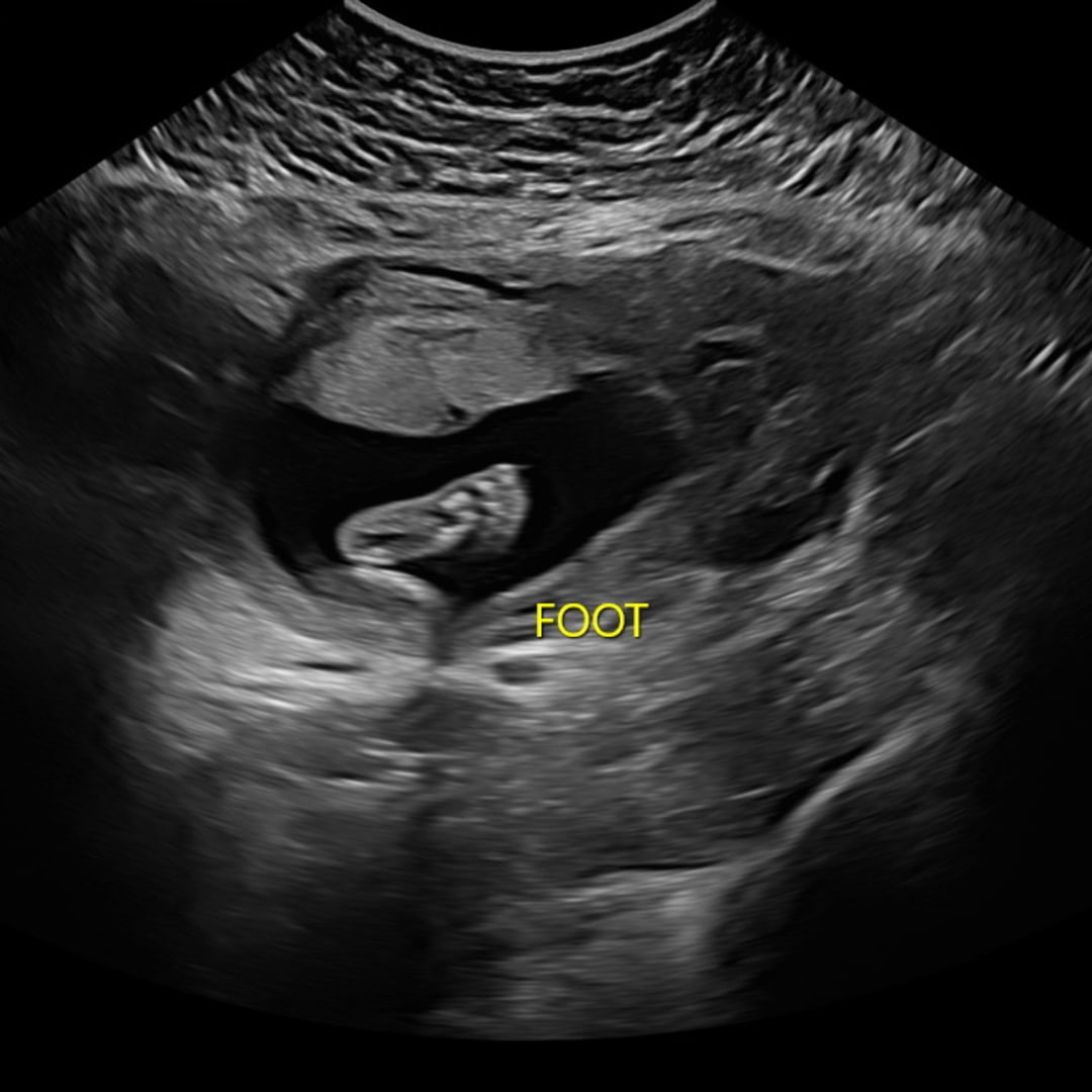 Photo shared by Breanna for their Babylist baby registry.