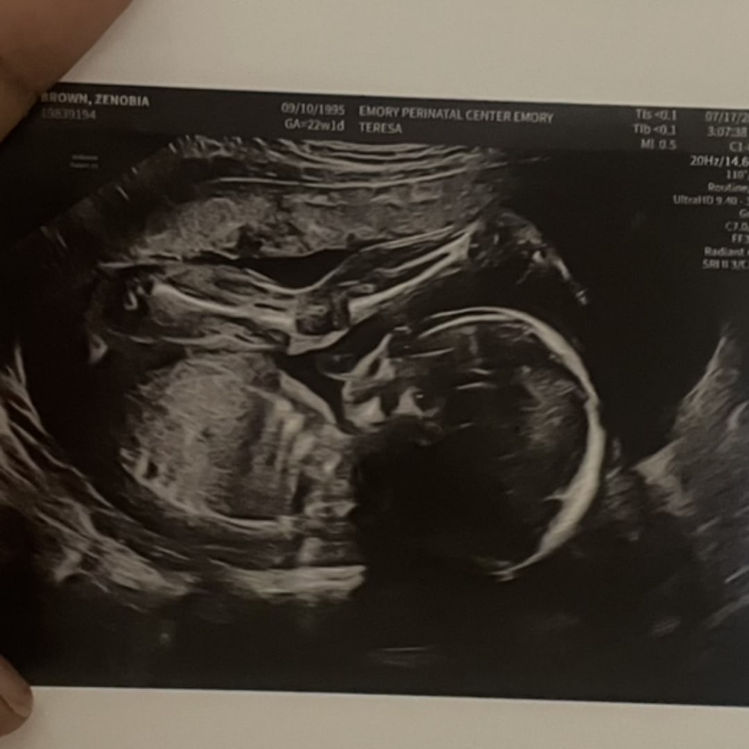 Photo shared by Zenobia for their Babylist baby registry.