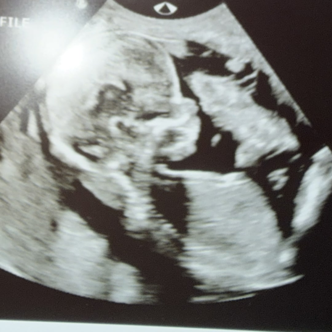 Photo shared by Deidra for their Babylist baby registry.