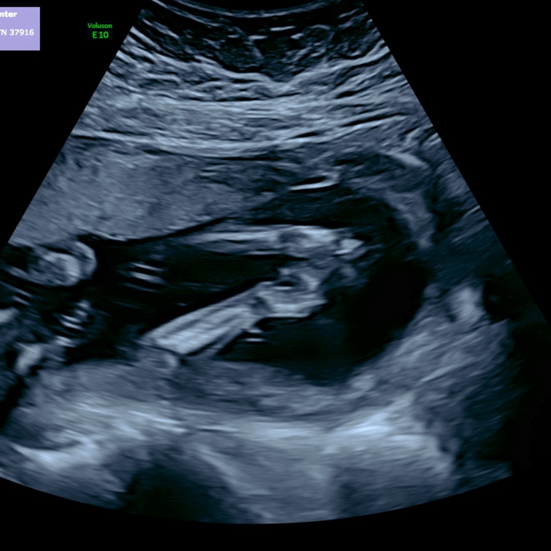 Photo shared by Megan for their Babylist baby registry.